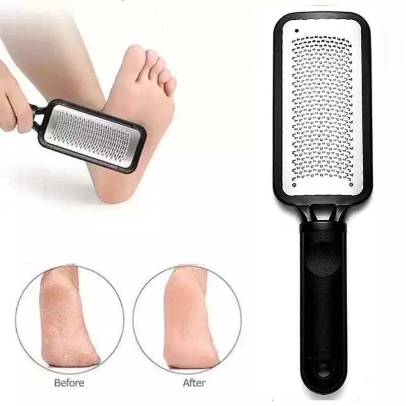 Professional Foot File Rasp Heel Grater Callus Remover Scrubber for Hard Skin — image 6